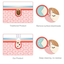 Load image into Gallery viewer, Microdermabrasion Diamond Facial Peeling Device Blackhead Removal Vacuum Pore Cleaner Acne Cleansing Blackhead Suction Machine - OZN Shopping
