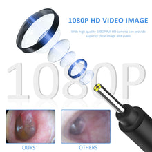 Load image into Gallery viewer, Ear Cleaner Wax Removal Tool Ear Cleaning Camera Otoscope Wireless LED Light Oral Inspection for Android IOS - OZN Shopping