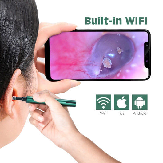 Ear Cleaner Wax Removal Tool Ear Cleaning Camera Otoscope Wireless LED Light Oral Inspection for Android IOS - OZN Shopping