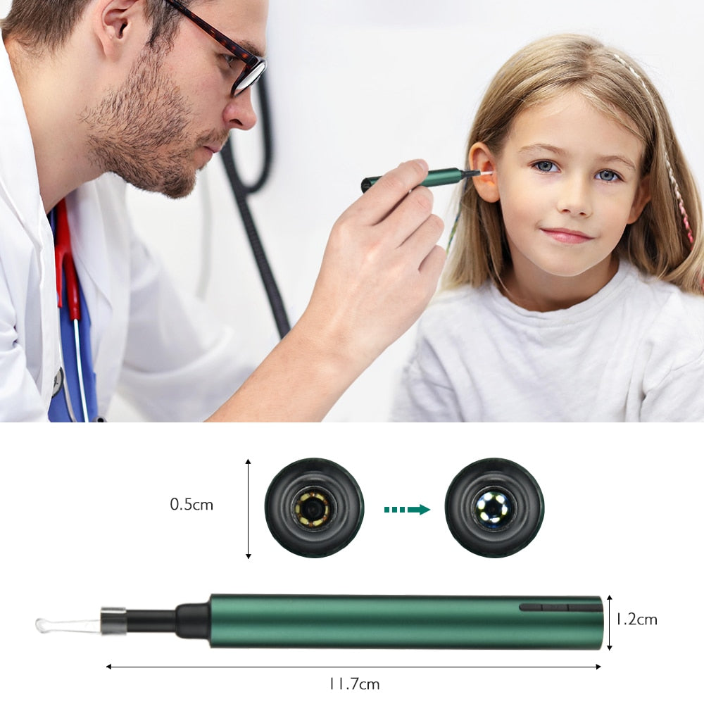 Ear Cleaner Wax Removal Tool Ear Cleaning Camera Otoscope Wireless LED Light Oral Inspection for Android IOS - OZN Shopping