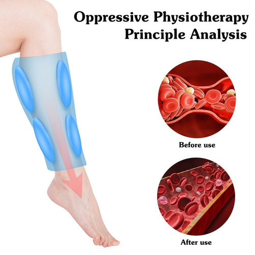 Legs Massager -  Legs Heat Compression Massage  Varicose Veins Physiotherapy - OZN Shopping